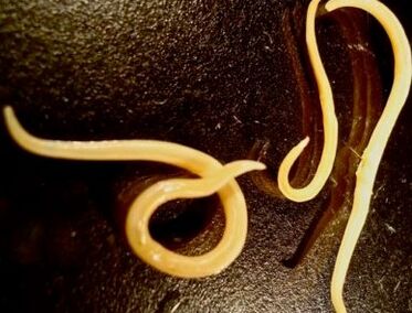 Worms