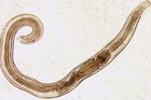 The parasites of a man of cuttings